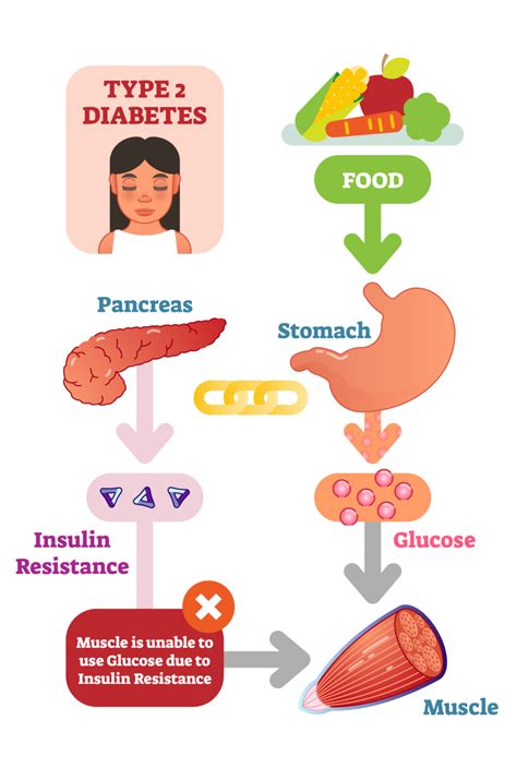 diabetes basics hunter diabetes centre