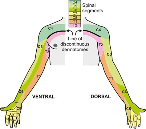 Upper Extremity Dermatomes And Myotomes Motor Function 45 Off