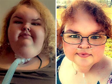 1000 Lb Sisters Star Tammy Slaton Shows Dramatic Weight Loss