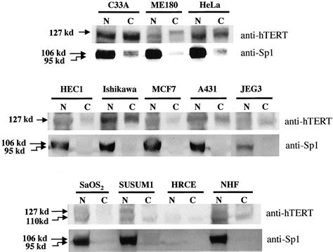 Significance Of Immunological Detection Of Human Telomerase Reverse