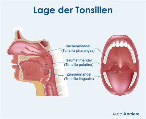 Tonsilla Palatina Gaumenmandel Anatomie Und Entz Ndung