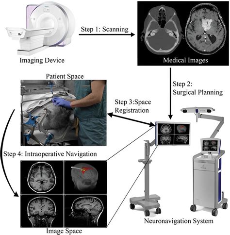 Workflow Of Neuronavigation The First Step Is Acquiring The Images