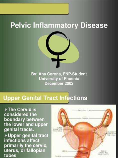 Acute Pelvic Inflammatory Disease Pid Medical Special