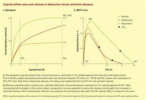 Pulmonary Function The Basics Medicine