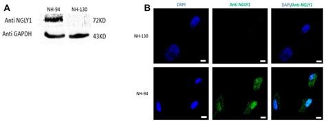 Frontiers Ngly1 Deficiency Zebrafish Model Manifests Abnormalities Of