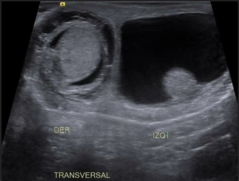 Myesr On Twitter Monday Is For A New Eurorad Case ️male Newborn