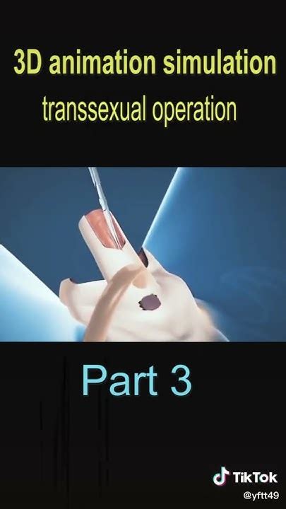 Gender Reassignment Surgery Male To Female Gender Reassignment Slowed