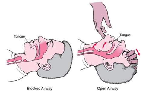 Airway Cpr Training First Aid How To Perform Cpr