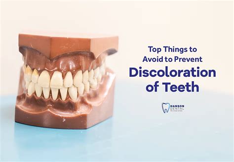 Top Things To Avoid To Prevent Discoloration Of Teeth Hanson Dental