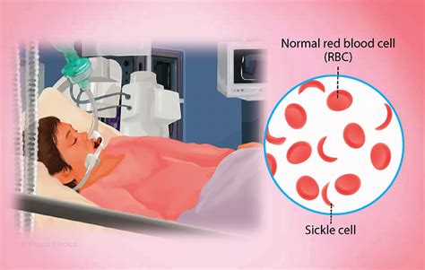 Health Condition : Symptoms, Causes, Treatment and More