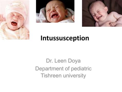 Intussusception Ppt