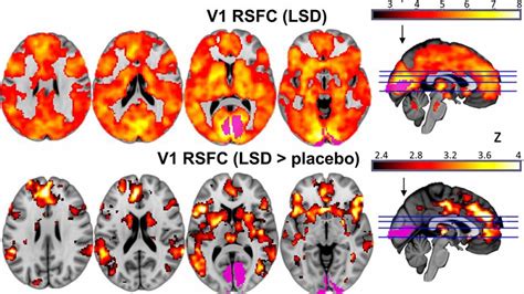 Des Drogues Hallucinogènes Pour Traiter La Dépression Et Les Dépendances