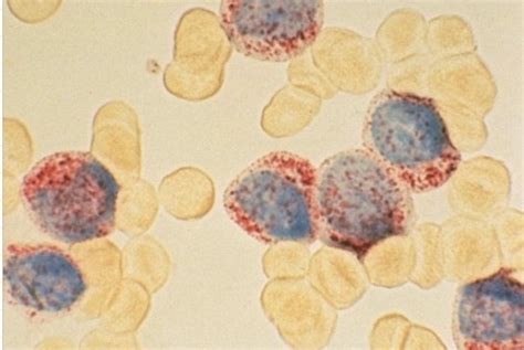 Wbc Morphology Pictures Flashcards Quizlet