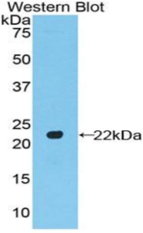 A26c2 Polyclonal Antibody Invitrogen™ 100 μl Unconjugated Ver