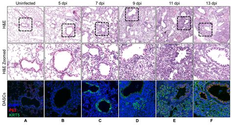 Cells Free Full Text Insights Into Early Recovery From Influenza