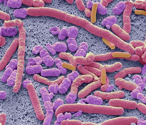 Probiotic Bacteria Photograph By Steve Gschmeissner Science Photo