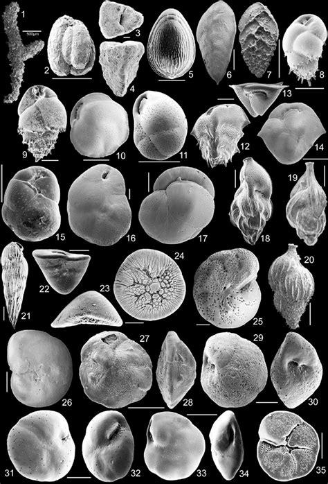 Benthic Foraminifera That Characterize The Recognized Sample