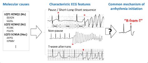 Long QT Syndrome Types