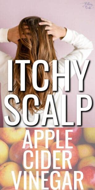 Apple Cider Vinegar For Itchy Scalp Also Includes Essential Oils And More