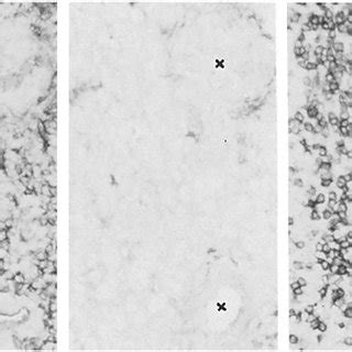 Immunocytochemistry Of The Periarterial Region Of Splenic White Pulp