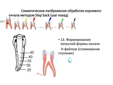 Стандартизированная методика обработки корневых каналов. Этапы ...