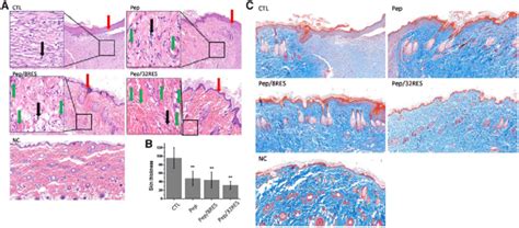 Histological Analysis Of Wound Surface After Treatment For Days A