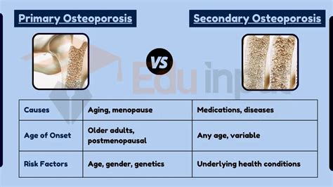 Difference Between Primary And Secondary Osteoporosis