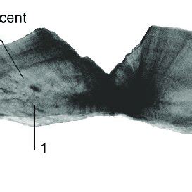 Sectioned Otolith Of Lutjanus Jocu Under Transmitted Light Showing The