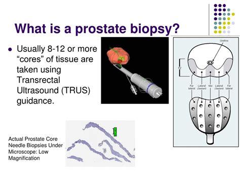 Prostate Biopsy Slides