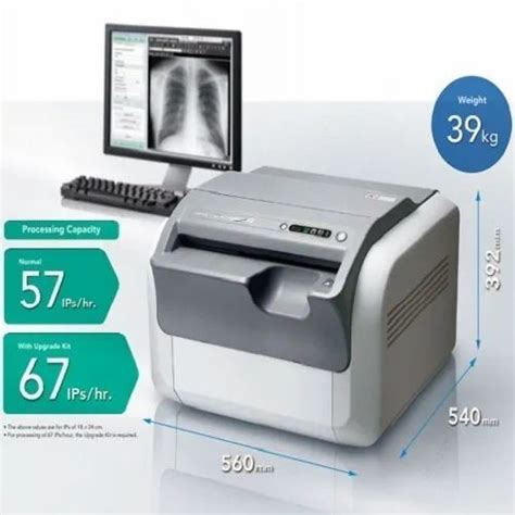 Fuji Cr Prima T At Rs 450000 FUJIFILM Computed Radiography System In