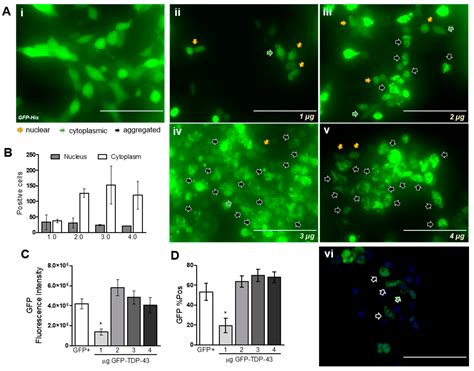 Cells Free Full Text TDP 43 Mediated Toxicity In HEK293T Cells A