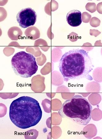 Plasma Cell Vs Lymphocyte