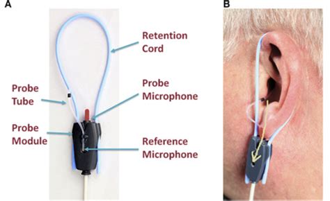 Hearing Aids Part Ii Aural Rehab Flashcards Quizlet