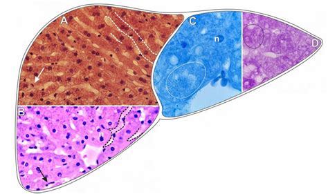 Scheme And Histological Sections Of The Liver Of Rabbits Allocated In