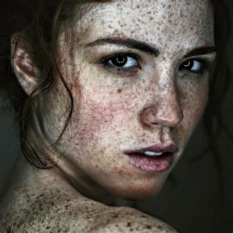 A Woman With Freckles On Her Face And Chest