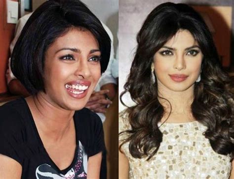 Bollywood Divas Who Opted Skin Lightening Treatment Find Health Tips