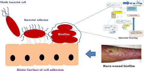 Development of burn wound-associated biofilm infection by the process ...