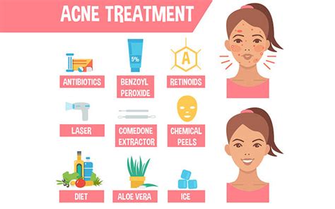 Can Acne Occur On Dry Skin? Know Its Causes, Treatments & Useful Tips ...