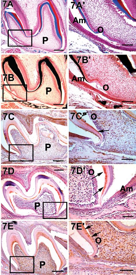 Temporal And Spatial Localization Of The Dentin Matrix Proteins During