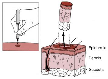 Diagnosis Of Skin Conditions VoltaicPlasma Areton LTD