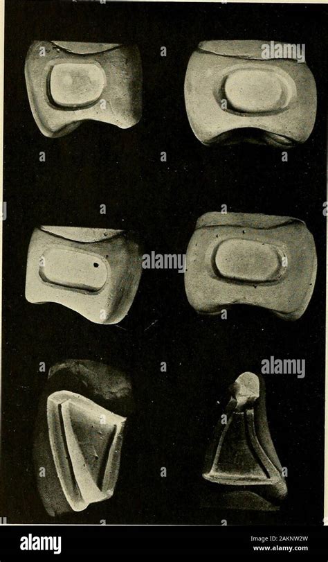 Principles And Practice Of Operative Dentistry I Simple Cavities