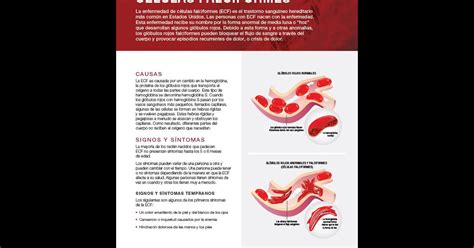 Enfermedad De Células Falciformes Sickle Cell Disease Nhlbi Nih