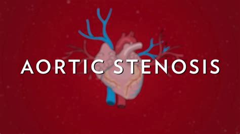 Aortic Stenosis In Seniors Explained Youtube