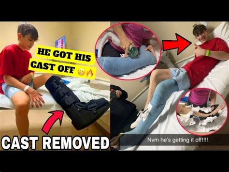 Nidal Wonder IS NOW GETTING His CAST REMOVED FROM His LEG Doctor