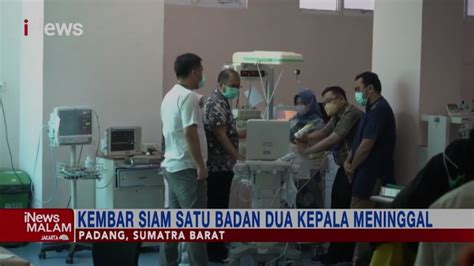 Bayi Kembar Siam Satu Badan Dua Kepala Di Padang Meninggal Dunia