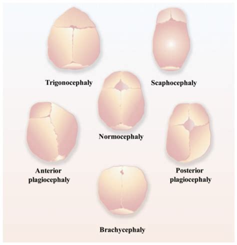 Biomolecules Free Full Text Cranial Suture Mesenchymal Stem Cells