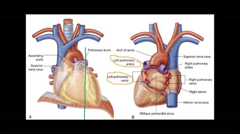 Sagittal Ct Chest With Mediastinal Window Youtube