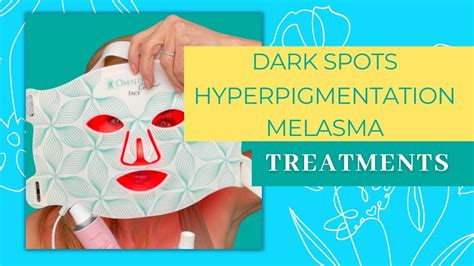 My Top Treatments For Hyperpigmentation Melasma Sunspots Youtube