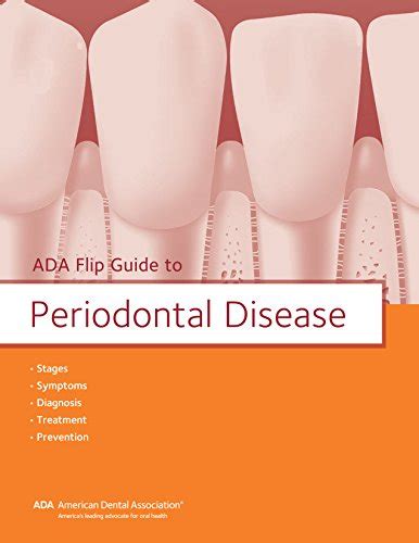 PDF ACCESS ADA Flip Guide To Periodontal Disease ADA Flip Guides