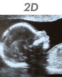 Pricing 3D Ultrasound And 4D Ultrasound Greensboro North Carolina